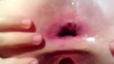 gape homemade anal